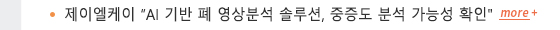 제이엘케이 'AI 기반 폐 영상분석 솔루션, 중증도 분석 가능성 확인'